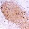 Ret Proto-Oncogene antibody, PA5-47019, Invitrogen Antibodies, Immunohistochemistry paraffin image 