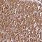 Nudix Hydrolase 12 antibody, NBP2-13681, Novus Biologicals, Immunohistochemistry paraffin image 