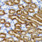 NAD(P)H Quinone Dehydrogenase 1 antibody, GTX09504, GeneTex, Immunohistochemistry paraffin image 