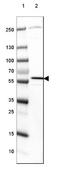 Methylcrotonoyl-CoA Carboxylase 2 antibody, NBP2-38403, Novus Biologicals, Western Blot image 