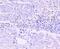 GATA Binding Protein 1 antibody, NBP2-66862, Novus Biologicals, Immunohistochemistry paraffin image 