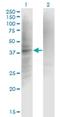  antibody, H00003426-M01, Novus Biologicals, Western Blot image 