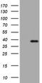 Kallikrein Related Peptidase 8 antibody, LS-C175654, Lifespan Biosciences, Western Blot image 