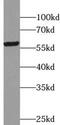 Tripartite Motif Containing 6 antibody, FNab08991, FineTest, Western Blot image 