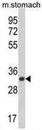 CDP-diacylglycerol--inositol 3-phosphatidyltransferase antibody, GTX80599, GeneTex, Western Blot image 