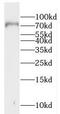 Golgi Associated, Gamma Adaptin Ear Containing, ARF Binding Protein 1 antibody, FNab03441, FineTest, Western Blot image 