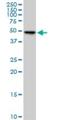 Protein O-Mannose Kinase antibody, H00084197-M03, Novus Biologicals, Western Blot image 