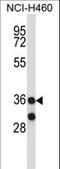  antibody, LS-C164033, Lifespan Biosciences, Western Blot image 