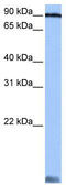 Alanyl-TRNA Synthetase antibody, TA345782, Origene, Western Blot image 