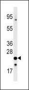 Frataxin antibody, PA5-13410, Invitrogen Antibodies, Western Blot image 