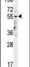 5-Hydroxytryptamine Receptor 3E antibody, PA5-24029, Invitrogen Antibodies, Western Blot image 
