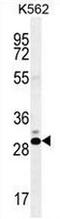 Cancer/Testis Antigen Family 45 Member A2 antibody, AP51113PU-N, Origene, Western Blot image 