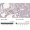 TATA-Box Binding Protein Associated Factor 15 antibody, NBP2-13410, Novus Biologicals, Immunohistochemistry paraffin image 