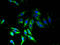 Transmembrane Protein 33 antibody, A61414-100, Epigentek, Immunofluorescence image 