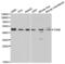 Thyroid Hormone Receptor Beta antibody, abx001332, Abbexa, Western Blot image 