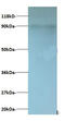 C-X-C Motif Chemokine Ligand 5 antibody, MBS715670, MyBioSource, Western Blot image 