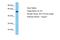 Aldehyde Dehydrogenase 1 Family Member A3 antibody, A30017, Boster Biological Technology, Western Blot image 