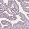 Dynein Regulatory Complex Subunit 3 antibody, HPA036041, Atlas Antibodies, Immunohistochemistry frozen image 