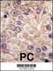 Phosphatidylinositol 4-Kinase Type 2 Beta antibody, LS-C101107, Lifespan Biosciences, Immunohistochemistry frozen image 