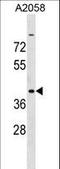 Adenosine Deaminase TRNA Specific 3 antibody, LS-C161009, Lifespan Biosciences, Western Blot image 