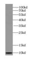 SEC61 Translocon Beta Subunit antibody, FNab07691, FineTest, Western Blot image 