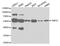 Lamina-associated polypeptide 2, isoforms beta/gamma antibody, MBS128742, MyBioSource, Western Blot image 