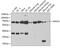 Monoamine Oxidase A antibody, GTX54351, GeneTex, Western Blot image 
