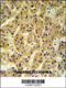 SEC24 Homolog A, COPII Coat Complex Component antibody, 61-630, ProSci, Immunohistochemistry paraffin image 