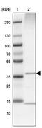 Aminolevulinate Dehydratase antibody, PA5-54310, Invitrogen Antibodies, Western Blot image 