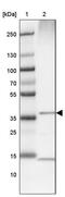 Aminolevulinate Dehydratase antibody, PA5-54310, Invitrogen Antibodies, Western Blot image 