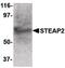 STEAP2 Metalloreductase antibody, PA5-20405, Invitrogen Antibodies, Western Blot image 