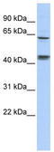 Kelch Like Family Member 8 antibody, TA345297, Origene, Western Blot image 