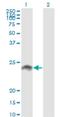 Cellular Communication Network Factor 5 antibody, H00008839-M09, Novus Biologicals, Western Blot image 