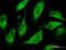 CDP-Diacylglycerol Synthase 1 antibody, H00001040-M01, Novus Biologicals, Immunocytochemistry image 