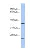 Methylenetetrahydrofolate Dehydrogenase (NADP+ Dependent) 2 Like antibody, NBP1-56468, Novus Biologicals, Western Blot image 