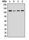 Aryl Hydrocarbon Receptor antibody, LS-C667691, Lifespan Biosciences, Western Blot image 