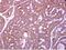 Zwilch Kinetochore Protein antibody, NBP2-21057, Novus Biologicals, Immunohistochemistry paraffin image 