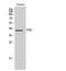 LRAT Domain Containing 2 antibody, A13540-1, Boster Biological Technology, Western Blot image 