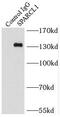 SPARCL1 antibody, FNab08154, FineTest, Immunoprecipitation image 