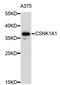 Casein Kinase 1 Alpha 1 antibody, STJ23241, St John
