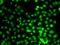 Lysine Methyltransferase 5A antibody, LS-B14225, Lifespan Biosciences, Immunofluorescence image 