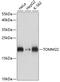 Translocase Of Outer Mitochondrial Membrane 22 antibody, GTX66265, GeneTex, Western Blot image 