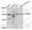 Syntaxin Binding Protein 4 antibody, A8287, ABclonal Technology, Western Blot image 