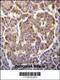 Phosphatidylinositol-4,5-Bisphosphate 3-Kinase Catalytic Subunit Beta antibody, 63-345, ProSci, Immunohistochemistry paraffin image 