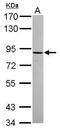 ADAM Metallopeptidase Domain 22 antibody, PA5-30639, Invitrogen Antibodies, Western Blot image 