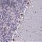 Chromosome 2 Open Reading Frame 49 antibody, NBP2-14404, Novus Biologicals, Immunohistochemistry frozen image 