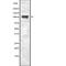 Ire1-alpha antibody, abx215234, Abbexa, Western Blot image 