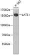 Large Tumor Suppressor Kinase 1 antibody, 22-749, ProSci, Western Blot image 