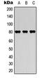 Myristoylated Alanine Rich Protein Kinase C Substrate antibody, LS-C368419, Lifespan Biosciences, Western Blot image 