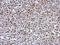 Kinesin Family Member 22 antibody, NBP2-17053, Novus Biologicals, Immunohistochemistry paraffin image 